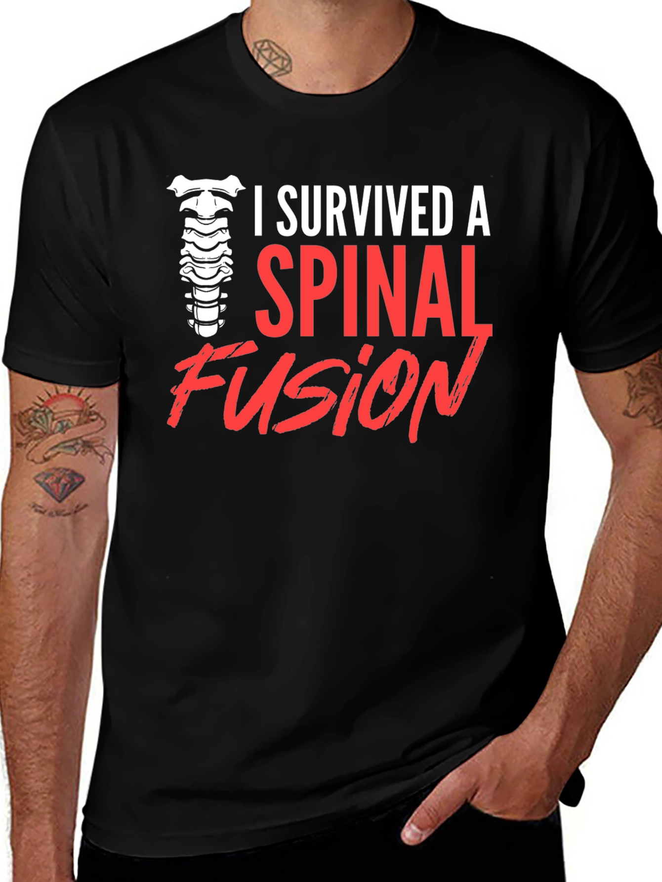 Spinal Fusion Survivor T-Shirt - Black